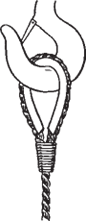 A wire rope eye secured with a thimble and wrapped with seizing wire